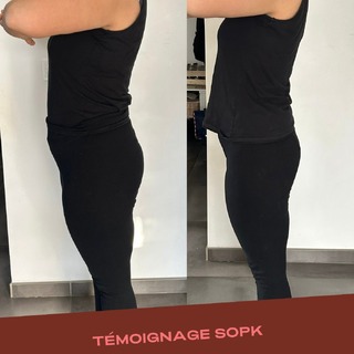 Cette transformation n’est pas le fruit du hasard.

Ma cliente a perdu 10 kg
(et amélioré sa composition corporelle)

Mais surtout :

elle a compris son corps (et elle a fait des efforts dans la bonne direction). 

Avant :

• stagnation
• frustration
• incompréhension

Aujourd’hui :

• plus d’énergie
• moins de douleurs
• progression durable

Ce qui a changé :

• une stratégie adaptée
• une alimentation structurée
• une compréhension de son métabolisme

Si vous voulez obtenir ce type de résultats :

⬇️ programmes et coaching dans la bio

#avantapres #sopk #syndromedesovairespolykystiques #resistancealinsuline #perdre10kg
